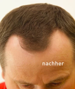 COVER HAIR Haarverdichtung Mit Schütthaar Mittelbraun -der Ankunftsshop MAM 5286138 SHOP IMAGE 1.53